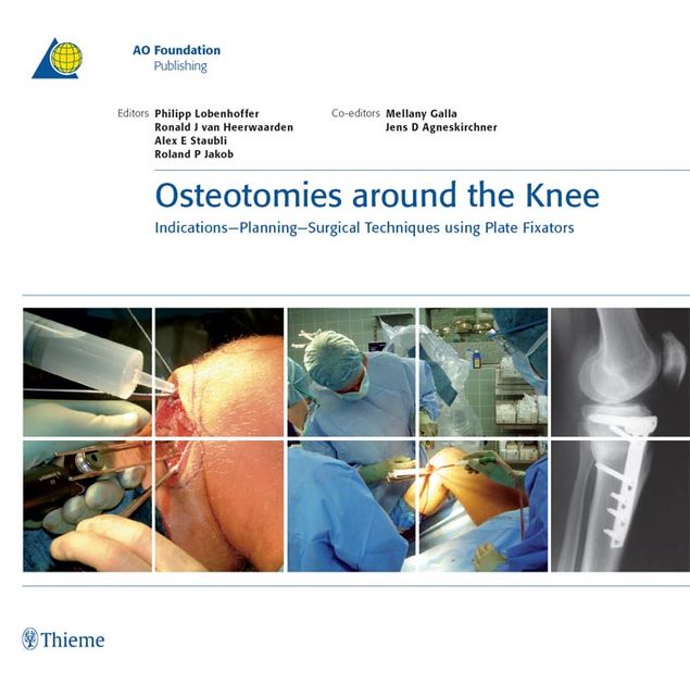Osteotomies around the Knee, Alex E.Staubli, Philipp Lobenhoffer, Ronald J.van Heerwaarden