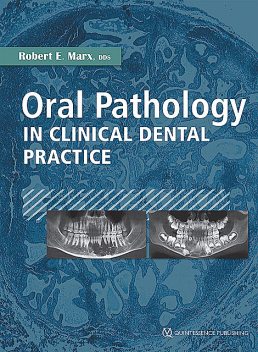 Oral Pathology in Clinical Dental Practice, Robert E. Marx