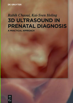 3D Ultrasound in Prenatal Diagnosis, Kai-Sven Heling, Rabih Chaoui
