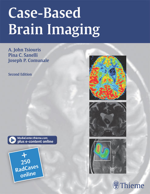 Case-Based Brain Imaging, A.John Tsiouris, Joseph P.Comunale, Pina C.Sanelli