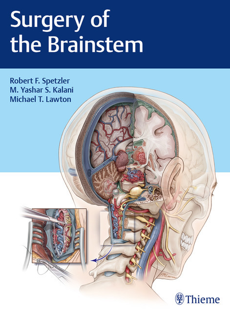Surgery of the Brainstem, Robert F.Spetzler, Michael T.Lawton, M.Yashar S.Kalani
