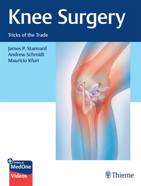 Knee Surgery, James P.Stannard, Andrew Schmidt, Mauricio Kfuri
