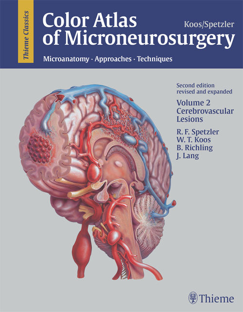Color Atlas of Microneurosurgery, Volume 2: Cerebrovascular Lesions, Robert F.Spetzler, Wolfgang T.Koos, B.Richling