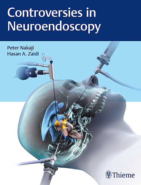 Controversies in Neuroendoscopy, Peter Nakaji, Hasan A. Zaidi