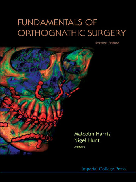 Fundamentals of Orthognathic Surgery, Malcolm Harris, Nigel Hunt