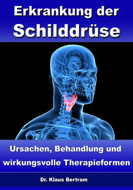 Erkrankung der Schilddrüse – Ursachen, Behandlung und wirkungsvolle Therapieformen, Klaus Bertram