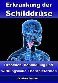 Erkrankung der Schilddrüse – Ursachen, Behandlung und wirkungsvolle Therapieformen, Klaus Bertram