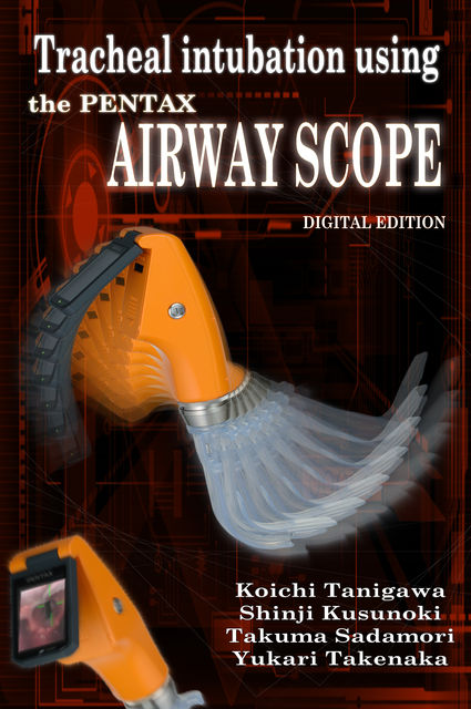 Tracheal intubation using the PENTAX Airway Scope, Koichi Tanigawa, Shinji Kusunoki, Takuma Sadamori, Yukari Takenaka