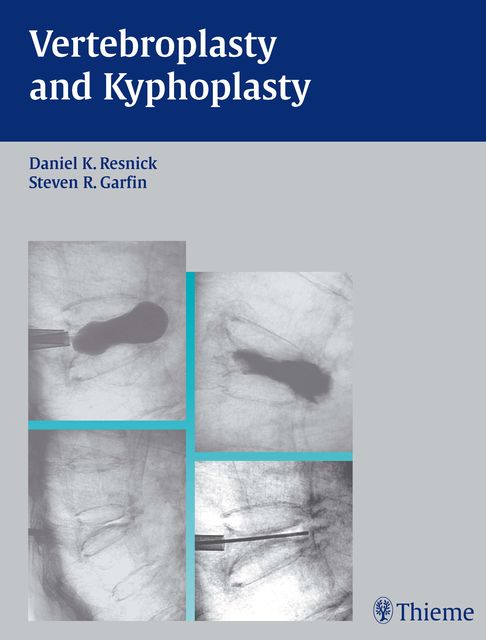 Vertebroplasty and Kyphoplasty, Daniel K.Resnick, Steven R.Garfin