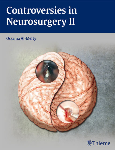 Controversies in Neurosurgery II, Ossama Al-Mefty
