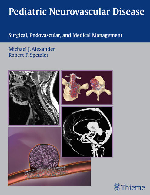 Pediatric Neurovascular Disease, Michael Alexander, Robert F.Spetzler, F.