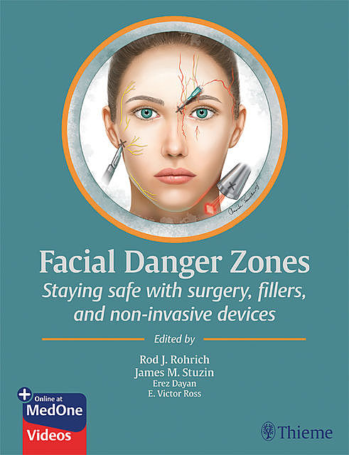 Facial Danger Zones, Rod J. Rohrich, E. Victor Ross, Erez Dayan, James M. Stuzin