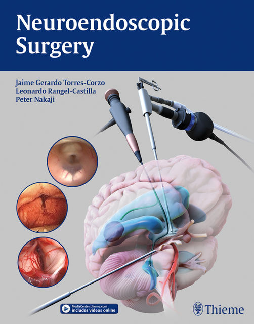 Neuroendoscopic Surgery, Peter Nakaji, Jaime Gerardo Torres-Corzo, Leonardo Rangel-Castilla