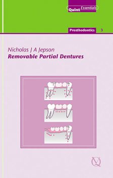 Removable Partial Dentures, Nicholas Jepson