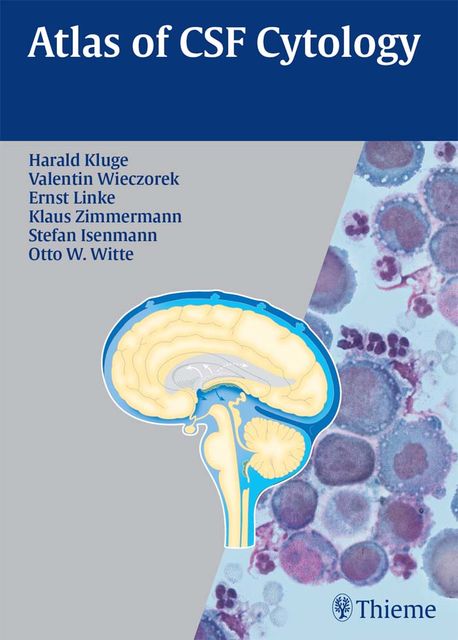 Atlas of CSF Cytology, Ernst Linke, Harald Kluge, Valentin Wieczorek