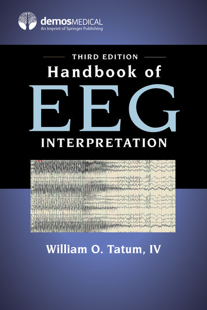 Handbook of EEG Interpretation, DO, IV, William O. Tatum