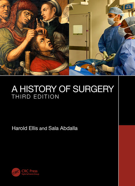 A History of Surgery, Harold Ellis, Sala Abdalla