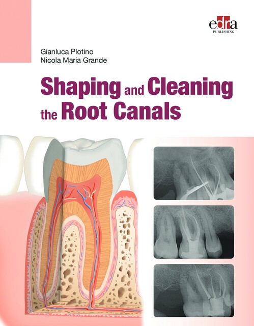 Shaping and Cleaning the Root Canals, Gianluca Plotino, Nicola Maria Grande