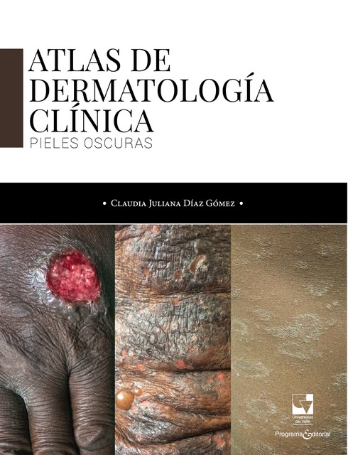 Atlas de dermatología clínica, Claudia Juliana Díaz Gómez