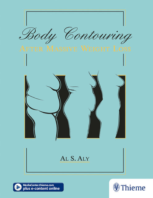 Body Contouring after Massive Weight Loss, Al S. Aly
