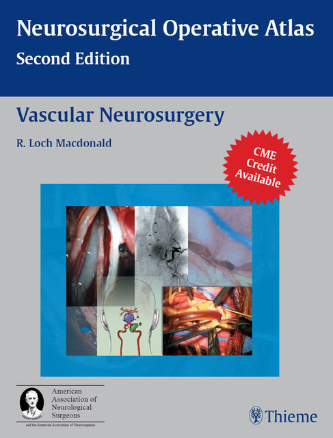 Vascular Neurosurgery, R.Loch Macdonald