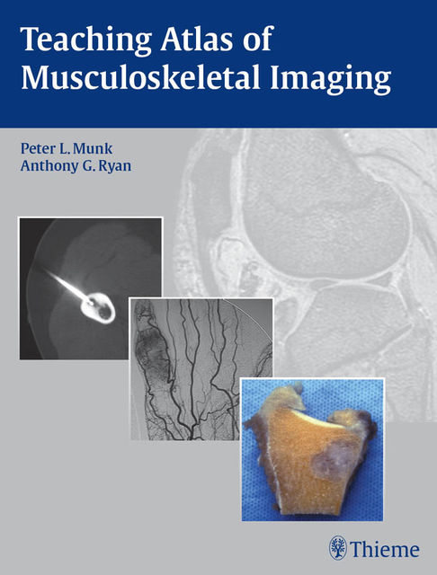 Teaching Atlas of Musculoskeletal Imaging, Ryan Anthony, Peter L.Munk