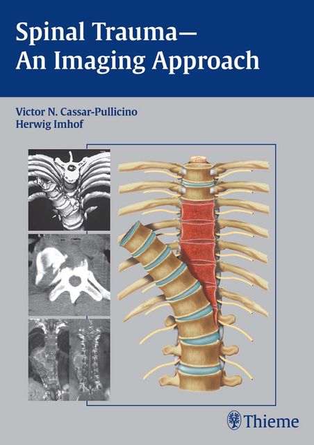 Spinal Trauma – An Imaging Approach, Herwig Imhof, Victor N.Cassar-Pullicino
