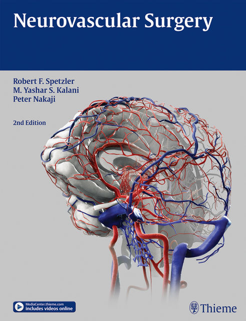 Neurovascular Surgery, Robert F.Spetzler, Peter Nakaji, M.Yashar S.Kalani
