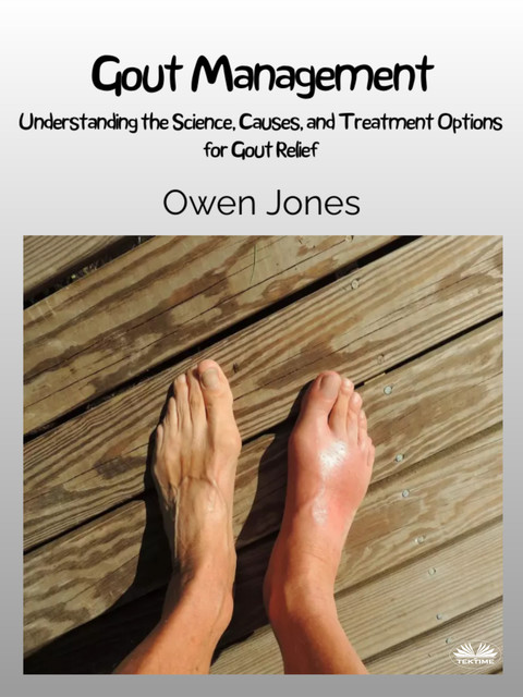 Gout Management-Understanding The Science, Causes, And Treatment Options For Gout Relief, Owen Jones